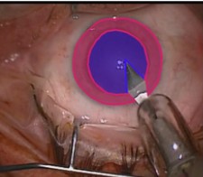 Instrumentenerkennung